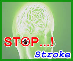 Stroke