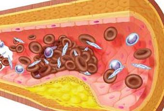 estudio-hiperlipidemia-mixta-T-Mg00_7